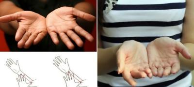 Veličina dlanova otkriva karakter: kako izgledaju vaši?