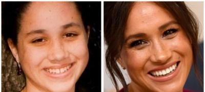 14 zvezda koje su jednom posetom stomatologu promenile izgled (foto)