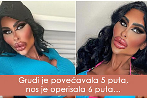 kako-izgleda-zena-koja-je-potrosila-preko-180-000-evra-na-estetske-korekcije-foto-01.jpg