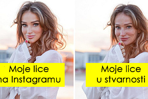 ovo-je-moje-lice-sa-borama-moje-opustene-grudi-strije-influenserka-pokazuje-da-je-instagram-zivot-nerealan-01.jpg