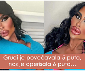 kako-izgleda-zena-koja-je-potrosila-preko-180-000-evra-na-estetske-korekcije-foto-01.jpg