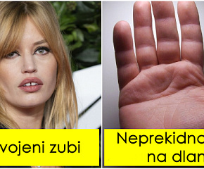razdvojeni-zubi-i-jos-7-retkih-karakteristika-koje-mozda-imate-i-vi-01.jpg