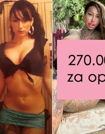 bizarna-zavisnost-od-prirodne-devojke-do-najplasticnije-zene-na-svetu-001.jpg