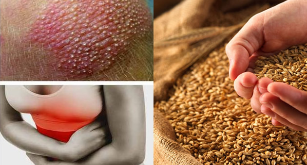 9-znakova-koji-ukazuju-na-preosetljivost-na-gluten.jpg
