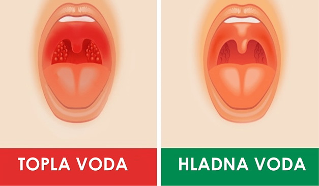 4-razloga-zasto-da-pijete-toplu-umesto-hladne-vode-03.jpg