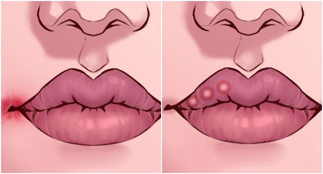promene-na-usnama-koje-mogu-da-ukazuju-na-neki-zdravstveni-problem-1.jpg