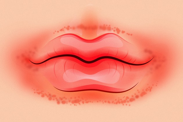 promene-na-usnama-koje-mogu-da-ukazuju-na-neki-zdravstveni-problem-5.jpg