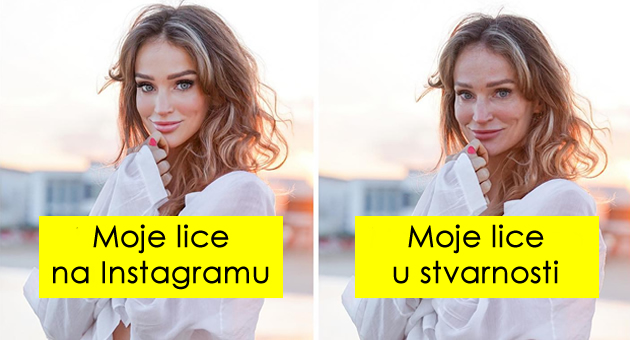 ovo-je-moje-lice-sa-borama-moje-opustene-grudi-strije-influenserka-pokazuje-da-je-instagram-zivot-nerealan-01.jpg